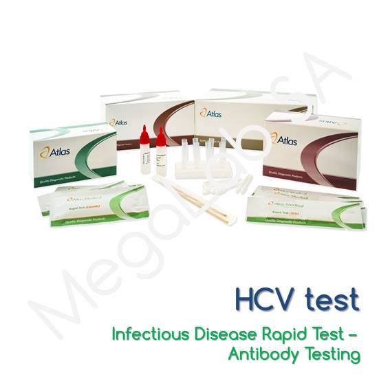 Τεστ ανίχνευσης αντισώματος ηπατίτιδας C (HCV)